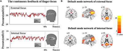 The Inter-Regional Connectivity Within the Default Mode Network During the Attentional Processes of Internal Focus and External Focus: An fMRI Study of Continuous Finger Force Feedback